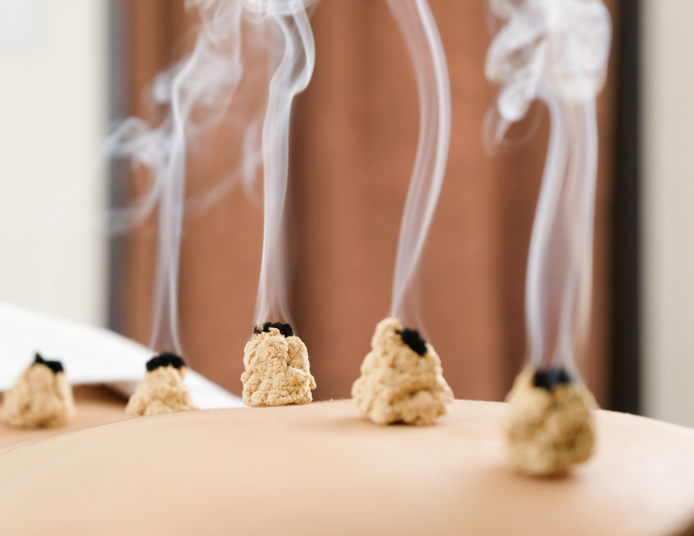 Moxibustion treatment